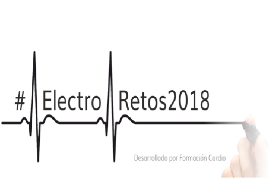 electroretos D